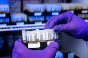 Comparative Analysis of IgG, IgA, IgM, IgD, and IgE Antibodies