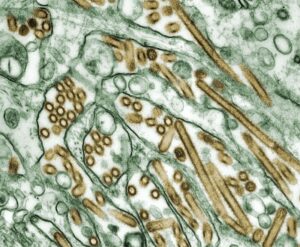 How Antibodies Can Be Used as Therapeutic Agents in Chronic Inflammatory Diseases