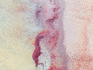 The Use of Antibodies in Diagnostic Tests Including ELISA, Western Blot, and Immunofluorescence