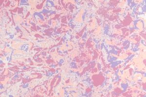 Using Antibodies for Targeted Delivery of Nanoparticles in Precision Drug Delivery Systems